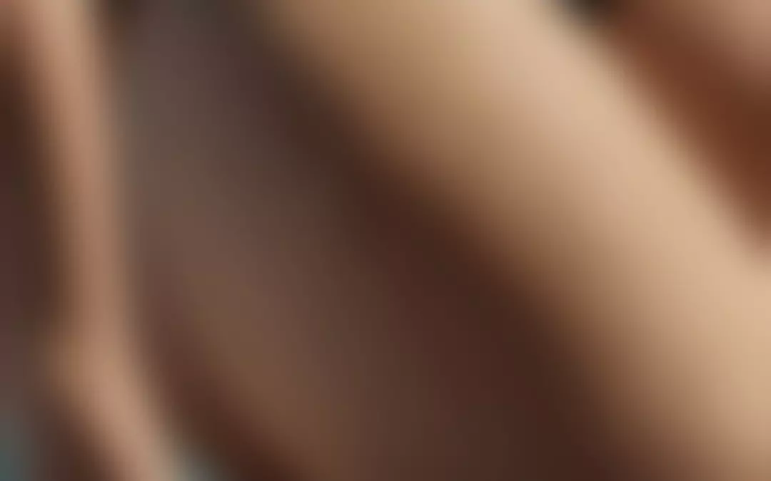 Dellen in den Beinen: Ursachen und effektive L&ouml;sungen