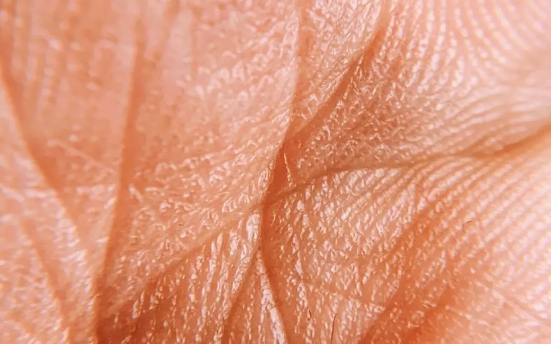 Der Lip&ouml;dem Kneiftest: Wie erkennt man Lip&ouml;dem effektiv?