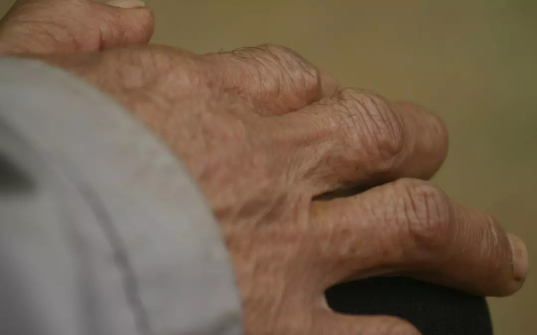 Lip&ouml;dem Lymphdrainage: Eine wirksame Therapieoption