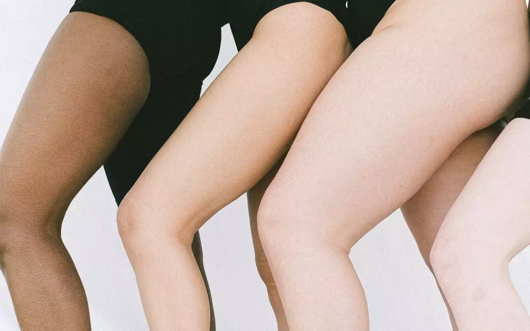 Wie entsteht ein Lip&ouml;dem?