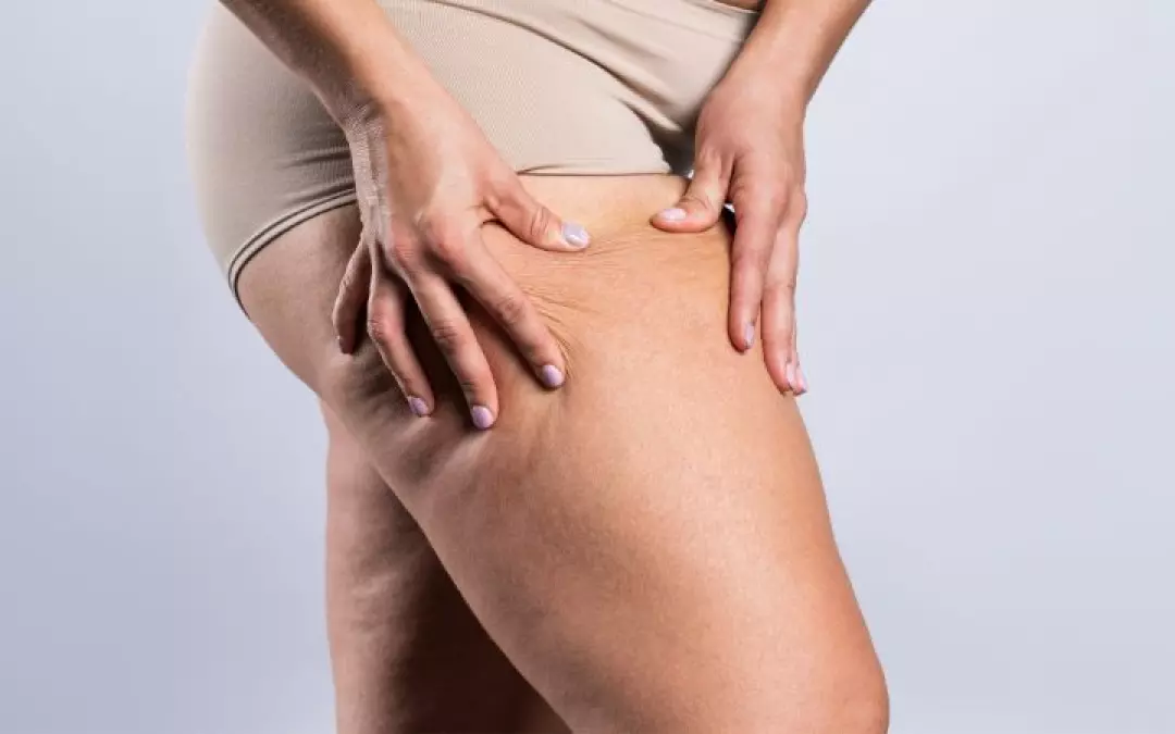 Schmerzen bei Lip&ouml;dem: Verstehen und Behandeln