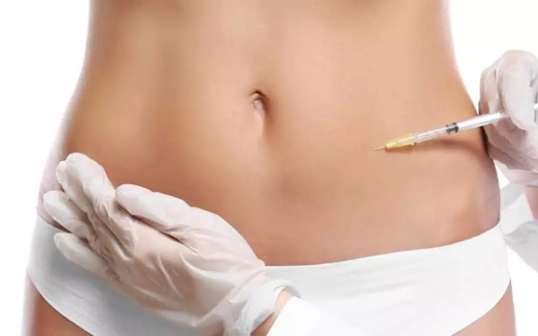 Alles &uuml;ber Injektionslipolyse: Technik und Anwendung