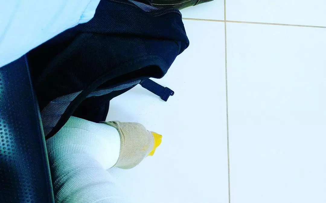 &Auml;derchen entfernen Kosten: Was m&uuml;ssen Sie erwarten?