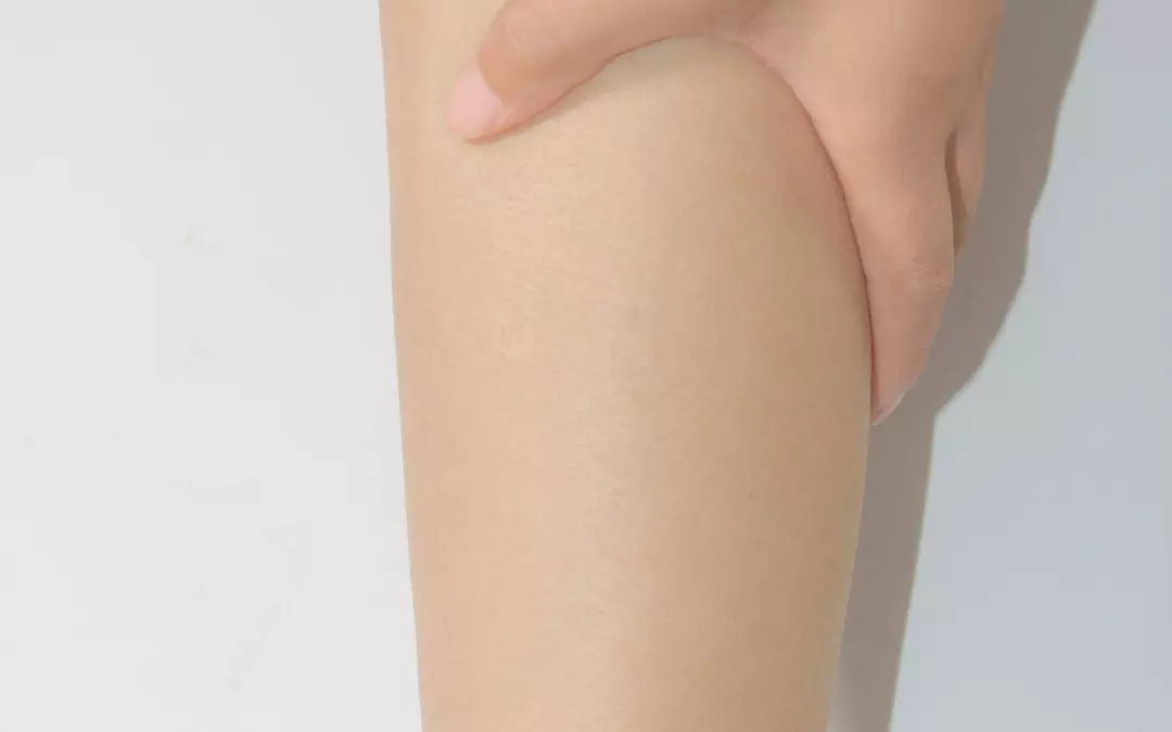 Sklerotherapie: Ein umfassender Leitfaden zur Venenbehandlung