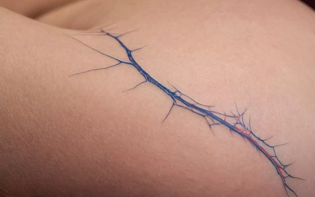 Besenreiser Stillzeit: Alles, was Sie wissen m&uuml;ssen