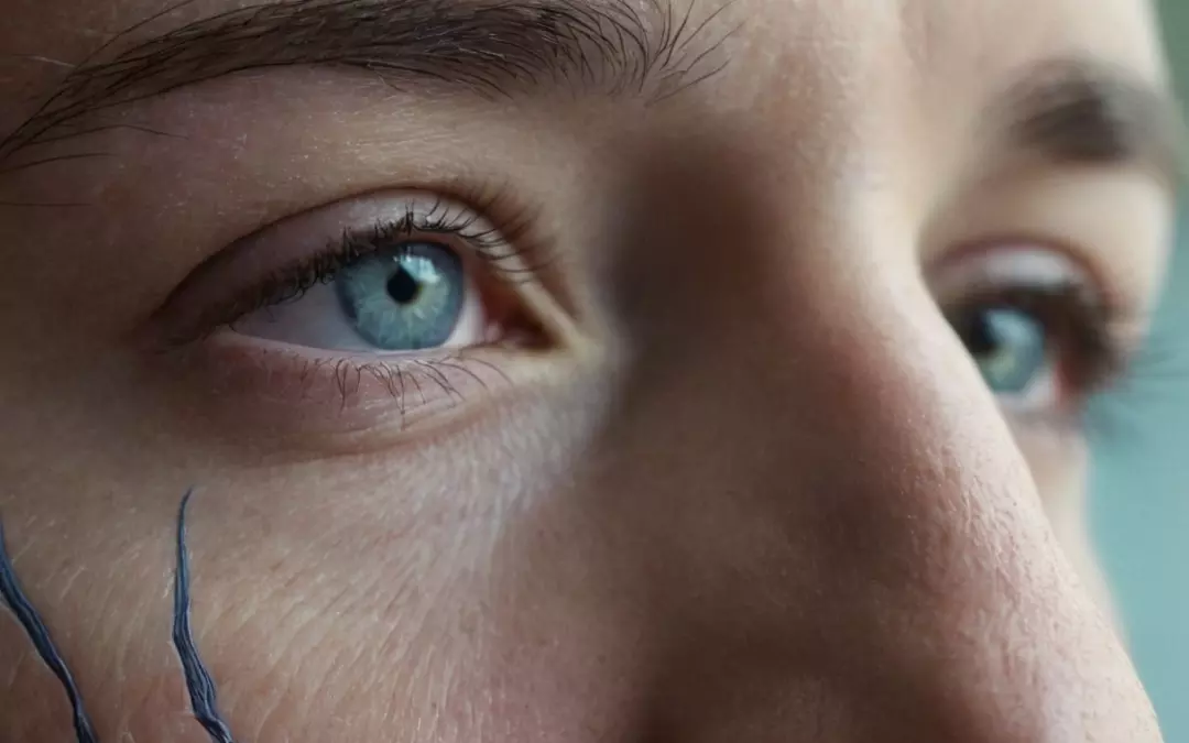 Blaue &Auml;derchen auf der Nase: Was Sie wissen m&uuml;ssen